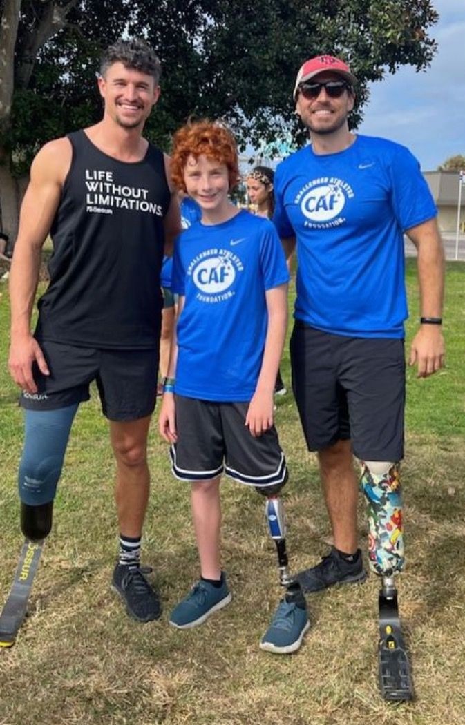 2 Physical therapist adults with 1 child whos wearing prosthetic legs
